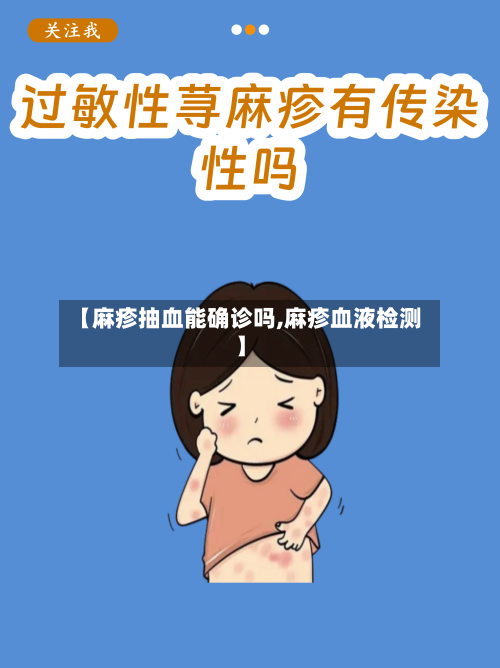【麻疹抽血能确诊吗,麻疹血液检测】