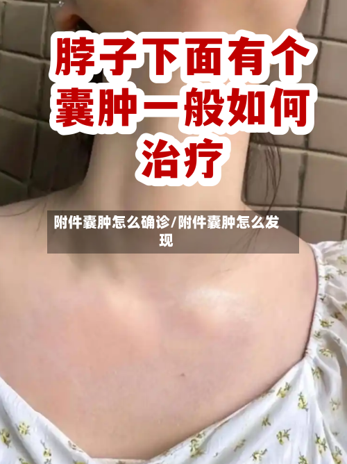 附件囊肿怎么确诊/附件囊肿怎么发现-第3张图片