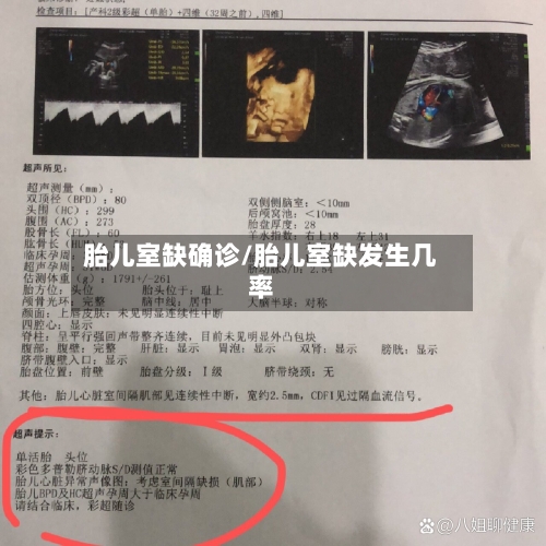 胎儿室缺确诊/胎儿室缺发生几率-第2张图片