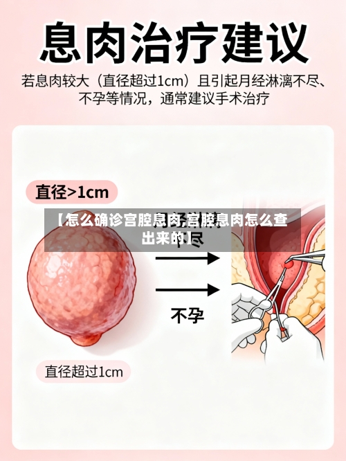 【怎么确诊宫腔息肉,宫腔息肉怎么查出来的】-第2张图片