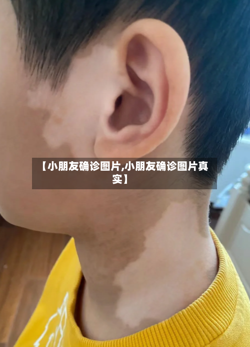 【小朋友确诊图片,小朋友确诊图片真实】-第2张图片