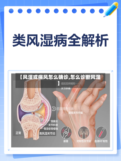 【风湿或痛风怎么确诊,怎么诊断风湿】-第2张图片