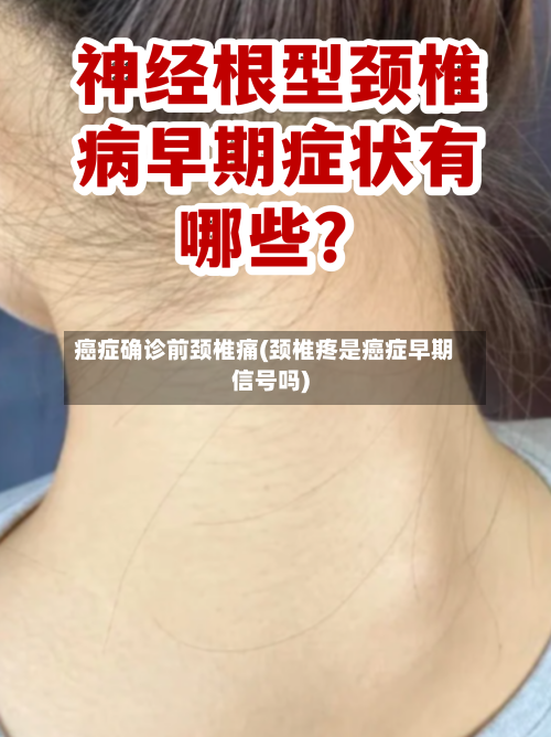 癌症确诊前颈椎痛(颈椎疼是癌症早期信号吗)-第2张图片