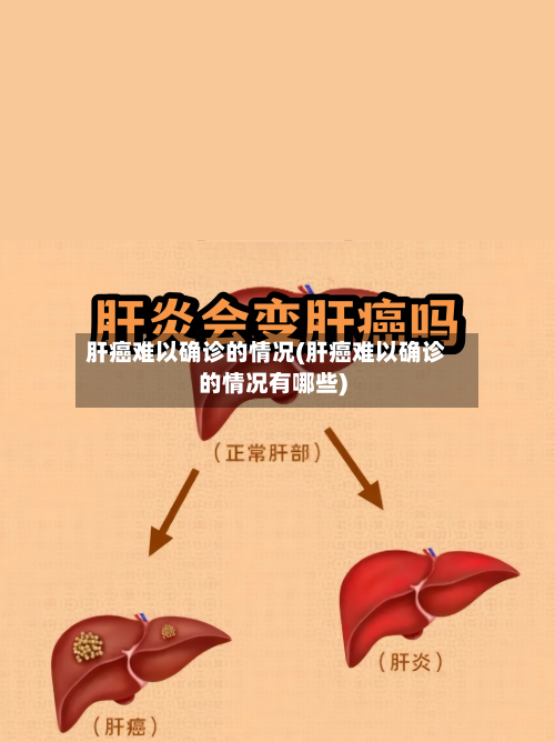 肝癌难以确诊的情况(肝癌难以确诊的情况有哪些)