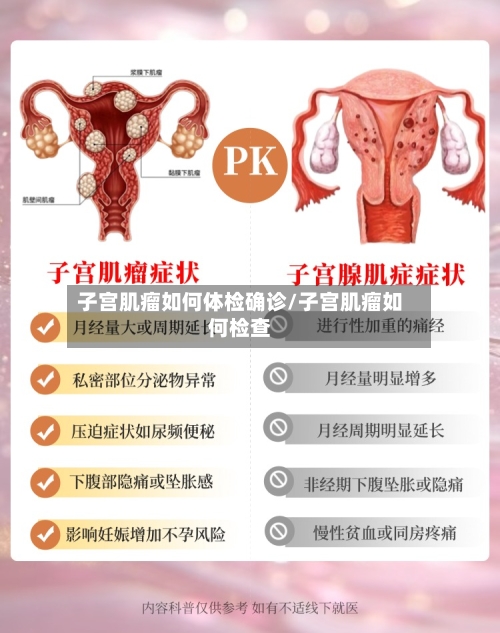 子宫肌瘤如何体检确诊/子宫肌瘤如何检查