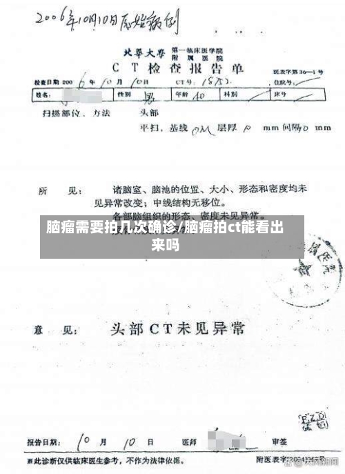脑瘤需要拍几次确诊/脑瘤拍ct能看出来吗
