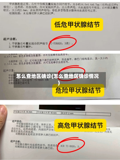 怎么查地区确诊(怎么查地区确诊情况)-第3张图片