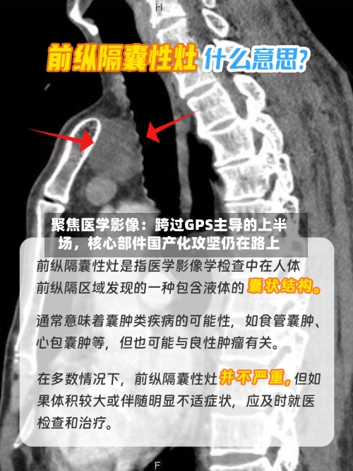 聚焦医学影像：跨过GPS主导的上半场	，核心部件国产化攻坚仍在路上-第2张图片