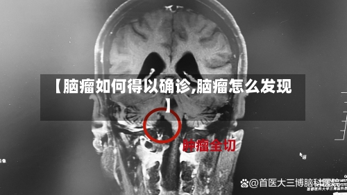 【脑瘤如何得以确诊,脑瘤怎么发现】