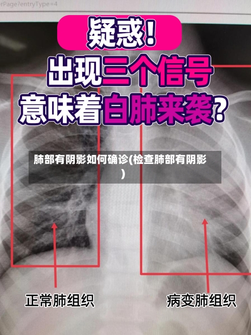 肺部有阴影如何确诊(检查肺部有阴影)