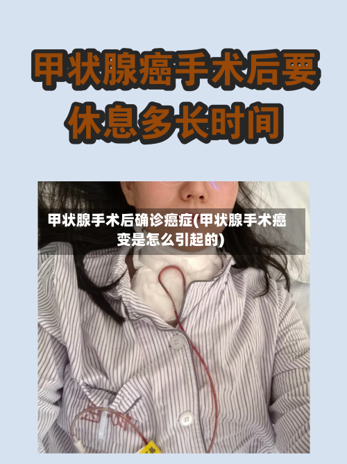 甲状腺手术后确诊癌症(甲状腺手术癌变是怎么引起的)-第3张图片